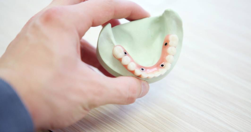 Imagine pentru articolul: Implanturile dentare, o piata de 107 milioane de euro in 2020. Numarul romanilor care le solicita s-a triplat in ultimii doi ani