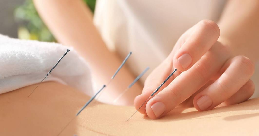 Imagine pentru articolul: De ce este important un tratament acupunctură și ce ar trebui să știm despre această practică străveche ?
