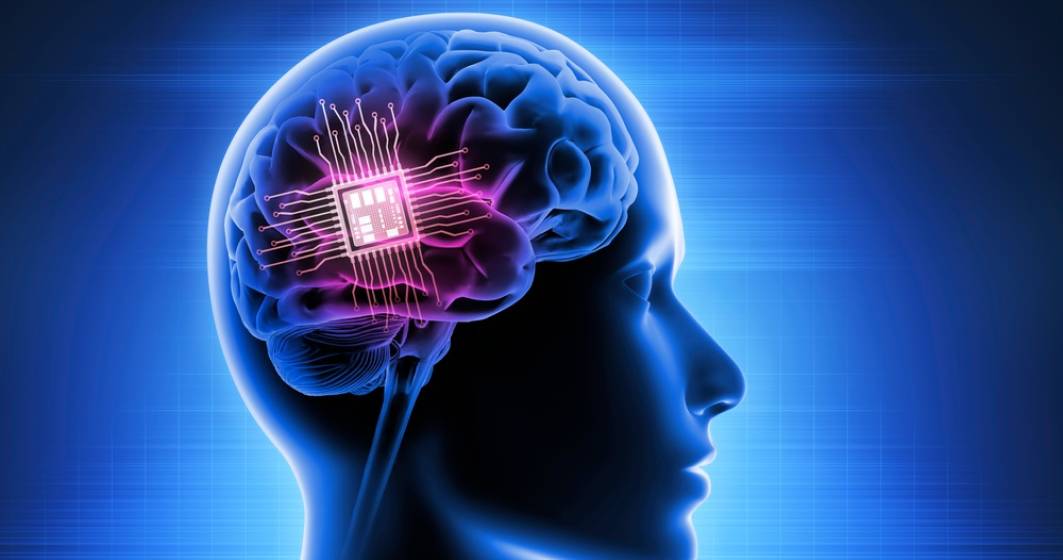 Imagine pentru articolul: Musk promite că în 6 luni lansează implanturile conectate în creierul uman