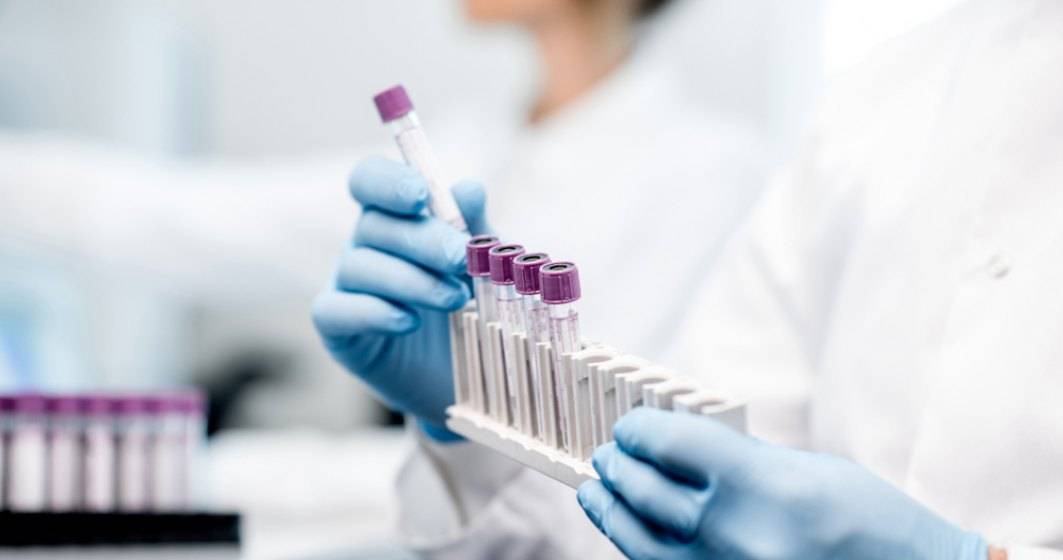 Imagine pentru articolul: Teste Real Time PCR pentru diagnosticarea COVID-19, disponibile la cerere în 25 de orașe din țară din rețeaua Synevo