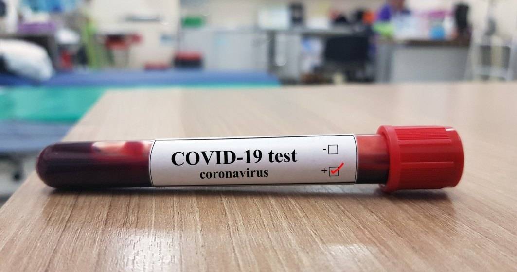 Imagine pentru articolul: Nelu Tătaru: Câte testări pentru COVID-19 au fost făcute în România de la începutul pandemiei