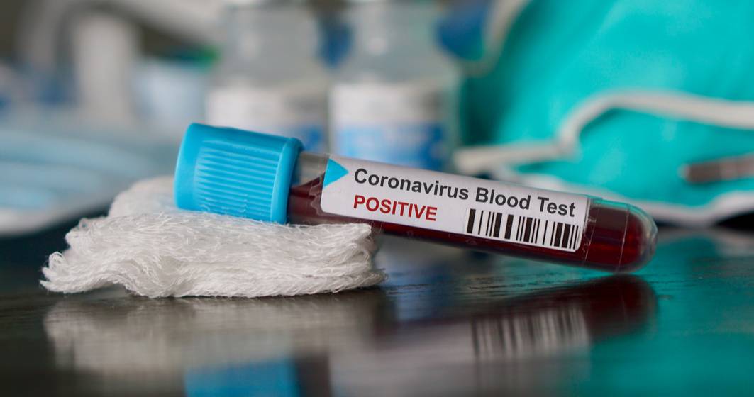 Imagine pentru articolul: Coronavirus 7 mai |