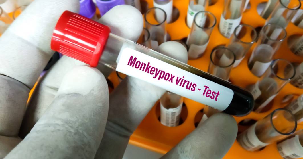 Imagine pentru articolul: Focarele de variola maimuței dau startul cursei pentru producția de vaccin