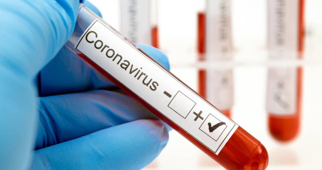 Imagine pentru articolul: Coronavirus | Spania a înregistrat 394 de decese în 24 de ore, o creștere de 30%